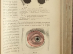 Traité d’Anatomie topographique avec applications medico-chirurgicales. Tom I-II